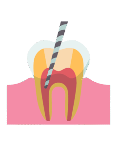Diseno Sin Titulo.zip 5 240x300
